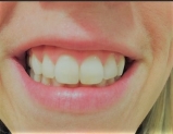 Dentalfetisch
